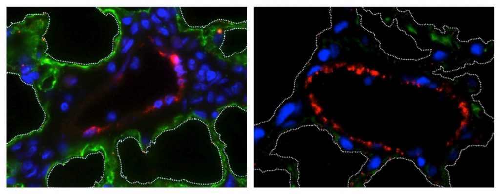 Researchers Can Now Bioengineer Lungs with the Original Blood Vessels Intact