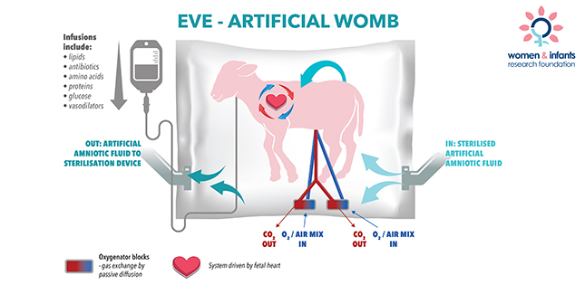 Further Research into Artificial Wombs Brings Us Closer to a Future Where Babies Grow Outside the Body